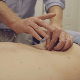 Upper Coomera Acupuncture post thumbnail