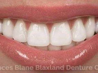 Blaxland Cottage Denture Clinic Frances Blane post thumbnail