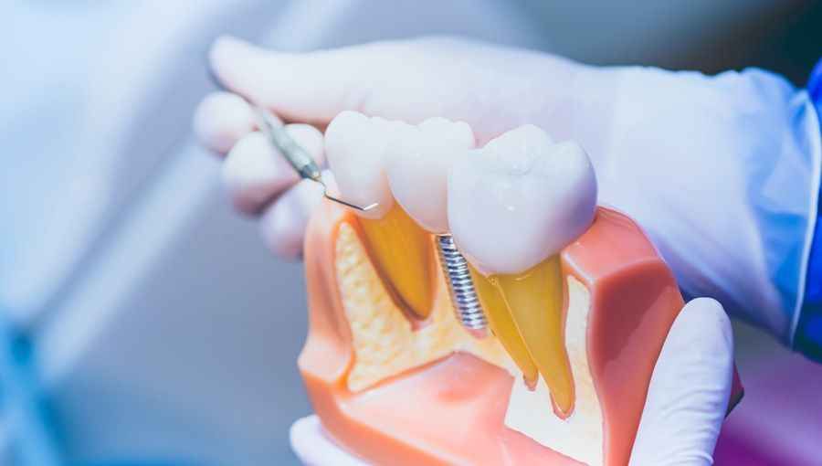 Davis Dental – Specialist Prosthodontist image