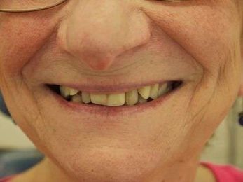 McGovern Denture Clinic gallery image 3