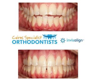 Cairns Specialist Orthodontists gallery image 20