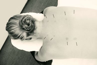 Bodhi Health Acupuncture gallery image 2