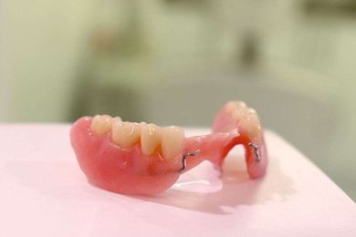 The Denture Clinic Belconnen gallery image 20
