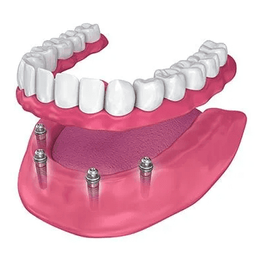 Central Coast Denture Clinic gallery image 1