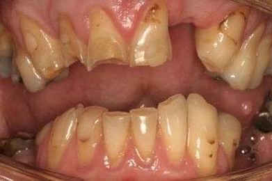 Davis Dental – Specialist Prosthodontist gallery image 3