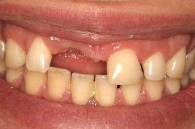 Davis Dental – Specialist Prosthodontist gallery image 1