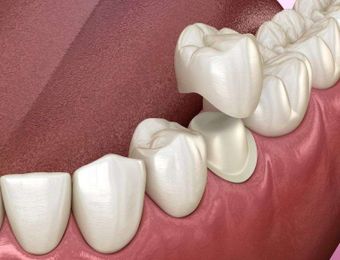 Isa Smiles Dental Care gallery image 7