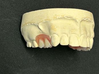 Precise Dentures gallery image 6