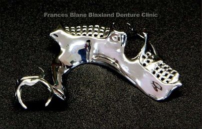 Direct Dentures Penrith and Blue Mountains Frances Blane gallery image 15