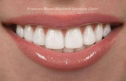 Direct Dentures Penrith and Blue Mountains Frances Blane gallery image 14