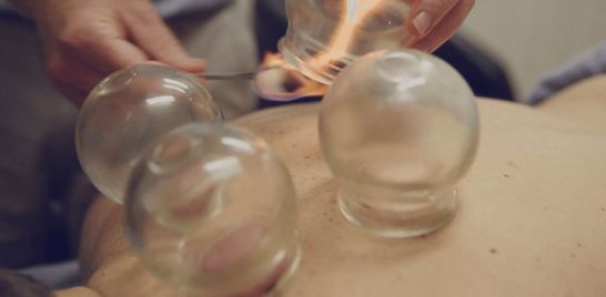 Cupping Benefits