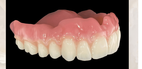 Full Dentures in as little as 2 appointments