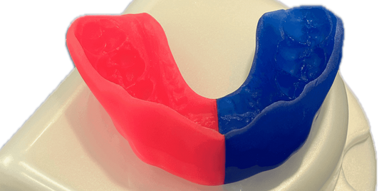 Custom fitted mouthguard