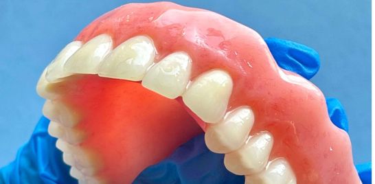 Transitioning to new dentures