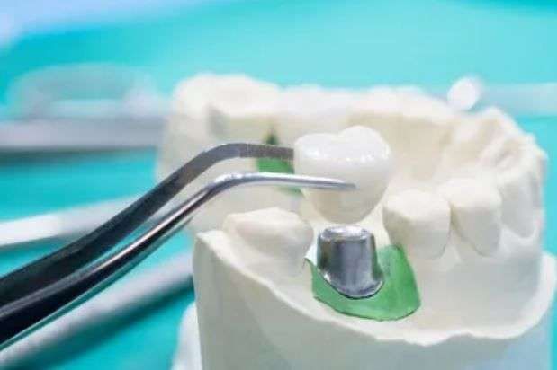Bytes of Lennox Dental featured image