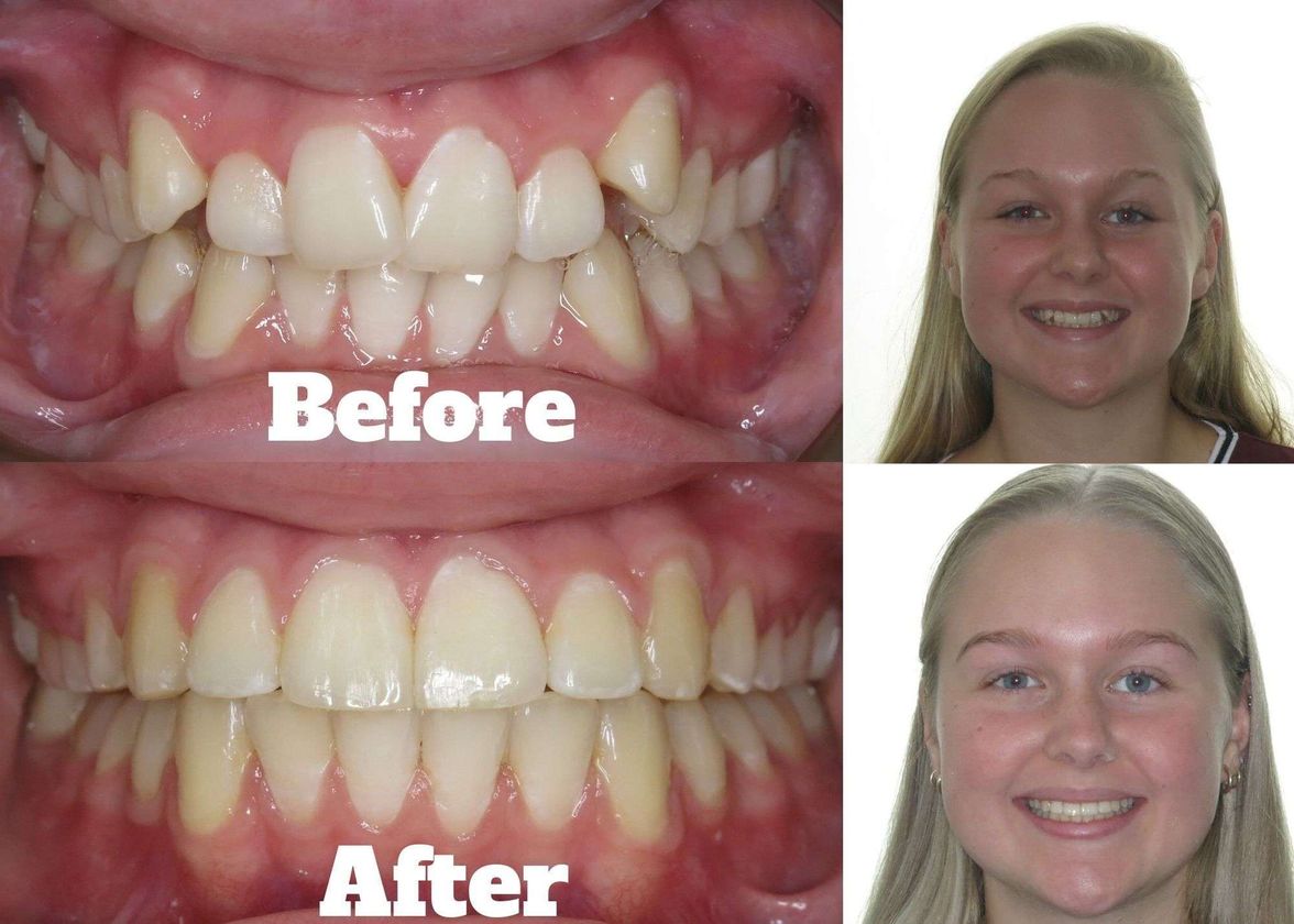 Townsville Orthodontic Specialists gallery image 10