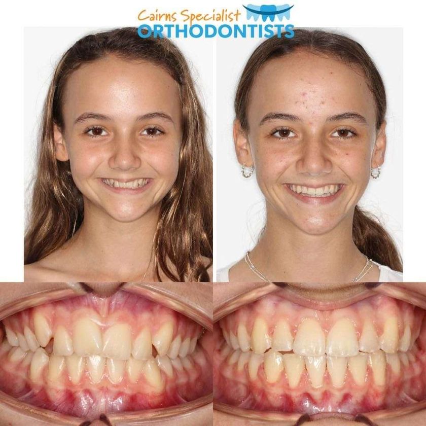 Cairns Specialist Orthodontists gallery image 5