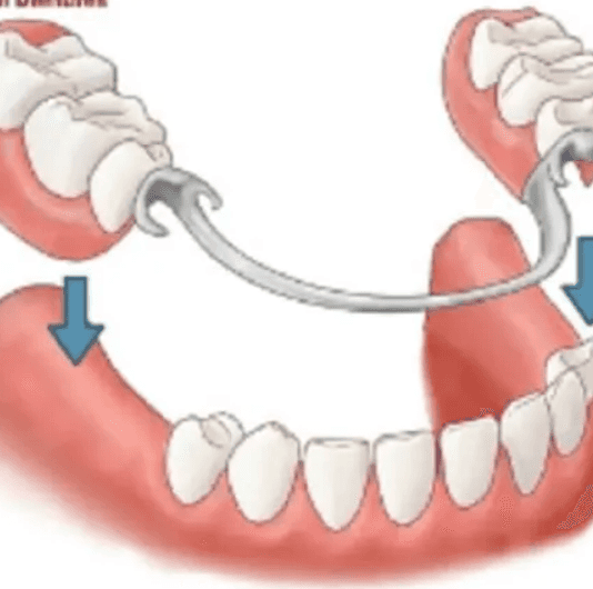 Geoffrey Bland Merewether Denture Clinic gallery image 3