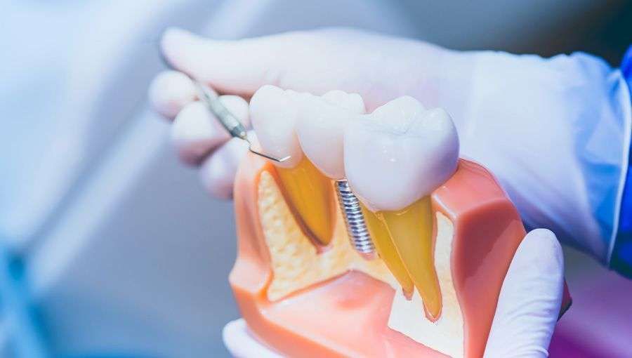 Davis Dental – Specialist Prosthodontist featured image