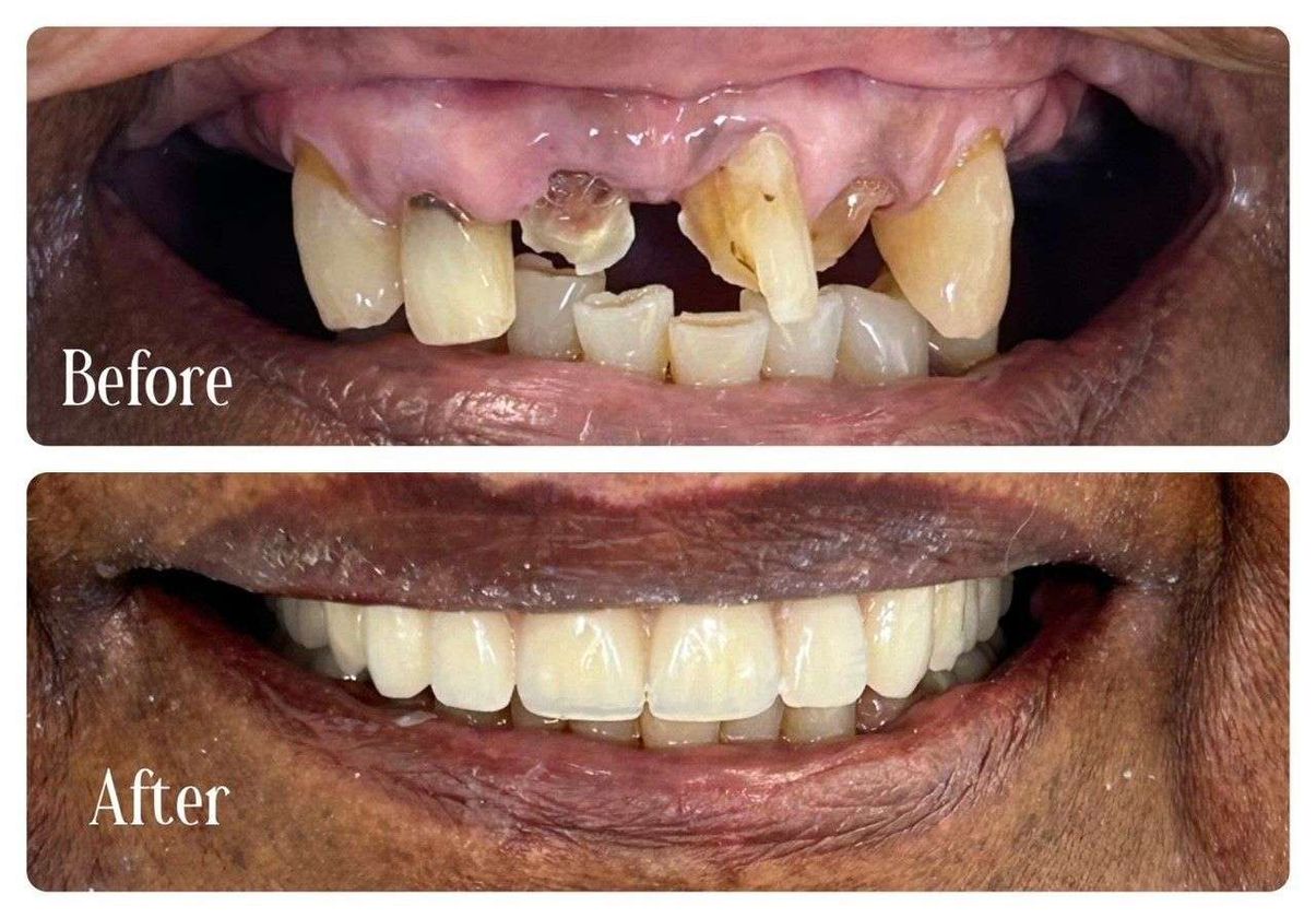 Precise Dentures featured image